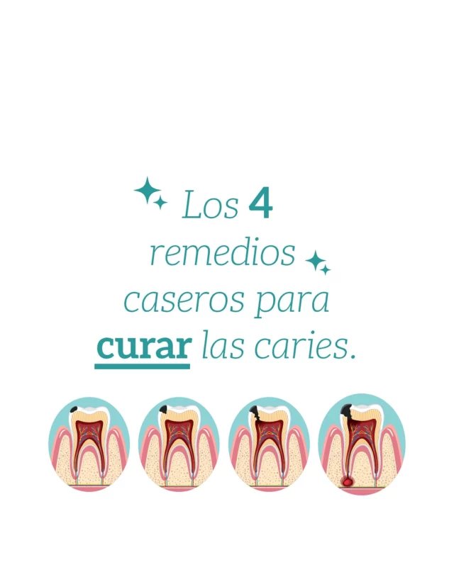 💥 ¡Tu sonrisa lo merece todo! 💥 Si alguna vez pensaste que los remedios caseros podían solucionar tus problemas de caries, es momento de replantearlo. 😬🔎 En ConfíaDent te ayudamos con tratamientos eficaces, rápidos y seguros. Porque la salud dental no es un juego, ¡es algo serio! 😷¿Estás listo para darle el cuidado que tu sonrisa necesita? ¡Agenda tu cita ahora mismo! 📅#mede #CuidadoDental #saludbucal #SonrisaSaludable #nomascaries #consultoriodental